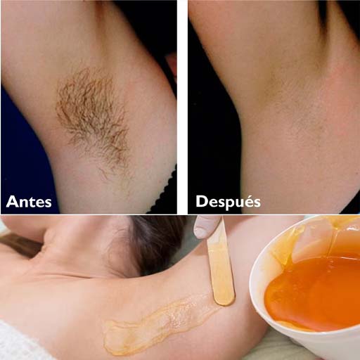 Depilacion axilas